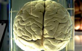 cerveau