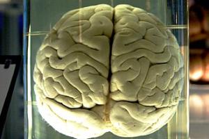 cerveau